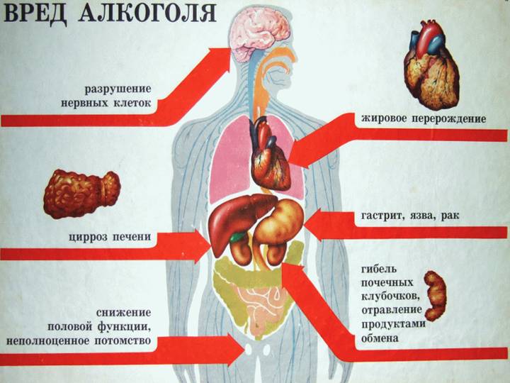 alko1